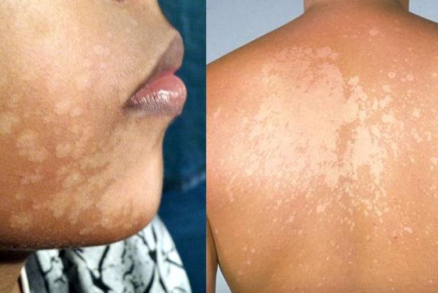 625.500.560.350.160.300.053.800.748.160.70 (1)