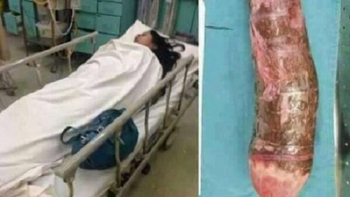 728x410_10518_Cassava-450x254