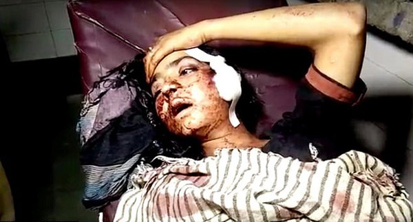 article_1494674846-403AD0BE00000578-4499600-Video_footage_showed_Ruby_being_taken_to_hospital_covered_in_blo-a-5_1494590584629