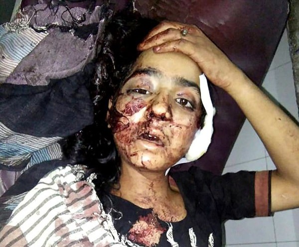 article_1494674861-403AD0C700000578-4499600-Ruby_was_attacked_after_her_younger_sister_overheard_her_talking-a-4_1494590584533