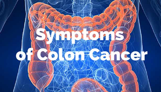 201706220827327775_will-come-whom-Colorectal-Cancer_SECVPF