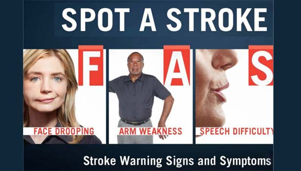 201708181333265510_Stroke-Warning-Signs_SECVPF
