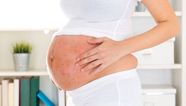 201708241134413282_Dangerous-symptoms-during-pregnancy_SECVPF