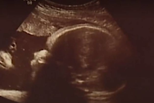 625.500.560.350.160.300.053.800.748.160.70 (2)