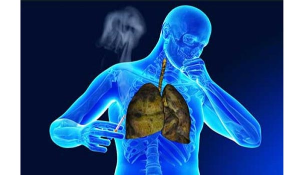 201709180820355246_Lung-damage-and-prevention_SECVPF