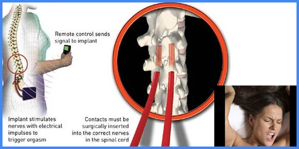 இயந்திரத்தின் உதவியுடன் ஆர்கஸம்! (அவ்வப்போது கிளாமர்)
