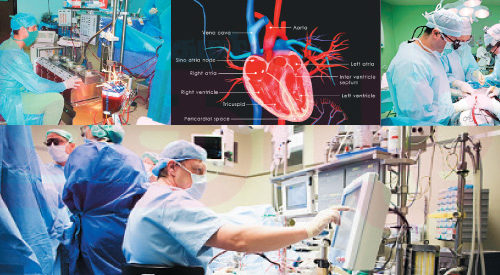 லப் டப்… லப் டப்  சொல்லும் பெர்ஃபியூசன் டெக்னாலஜி! (மருத்துவம்)