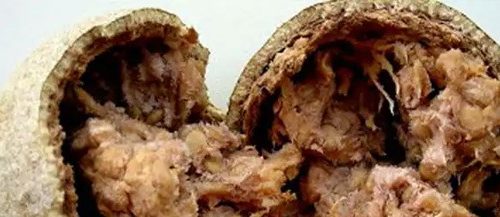 பல் வலிமைக்கு விளாம்பழம்!! (மருத்துவம்)