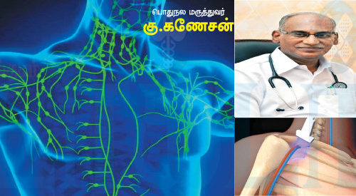 நிணத்திசுப் புற்றுநோய் தடுப்பது எப்படி? (மருத்துவம்)