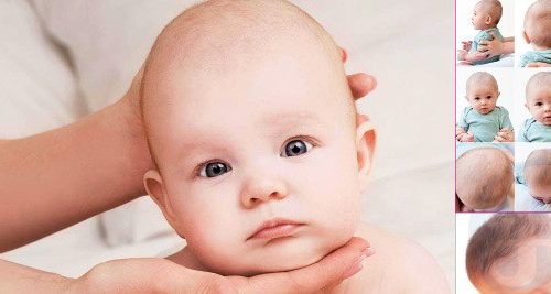 உரம் விழுதல் சில உண்மைகள்!!(மருத்துவம்)