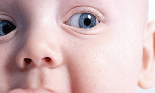 குழந்தைக்கு கண்ணில் பூ விழுந்திருக்கா!! (மருத்துவம்)