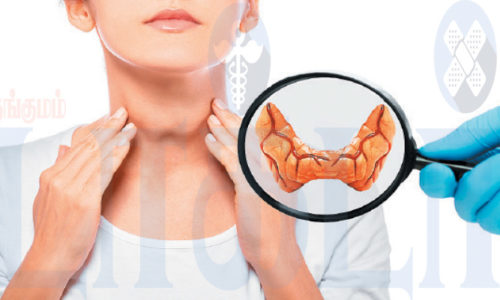 தைராய்டு பிரச்சனைகளும் தீர்வும்!   (மருத்துவம்)